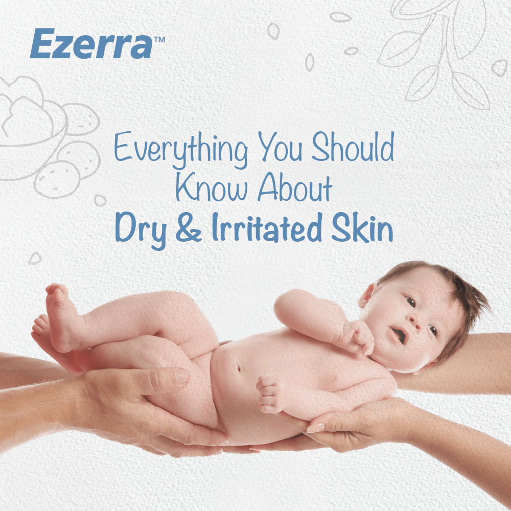 everything about dry irritated baby skin