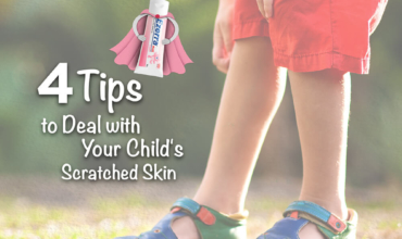 Deal with child's scratched dry skin