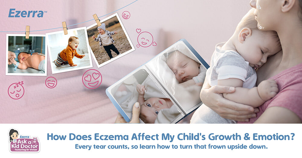 How Does Eczema Affect My Child's Growth & Emotion?