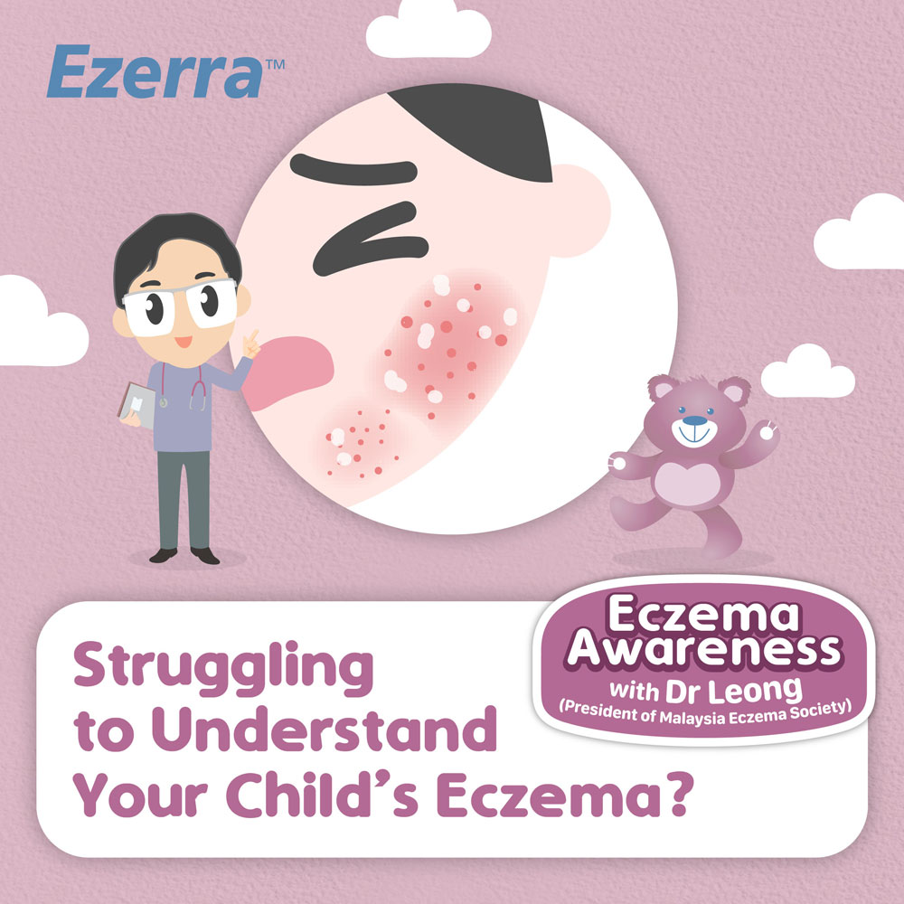 Understand Your Child Eczema