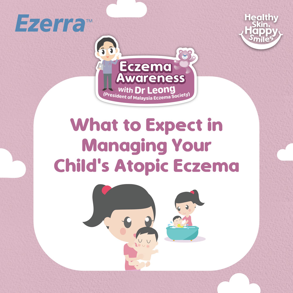 Managing Child's Eczema